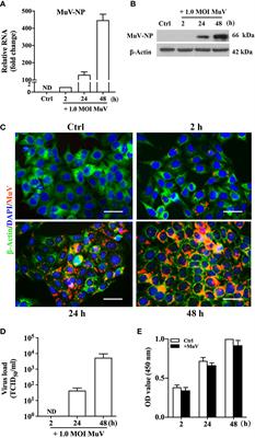 Characterization of an Antiviral Component in Human Seminal Plasma